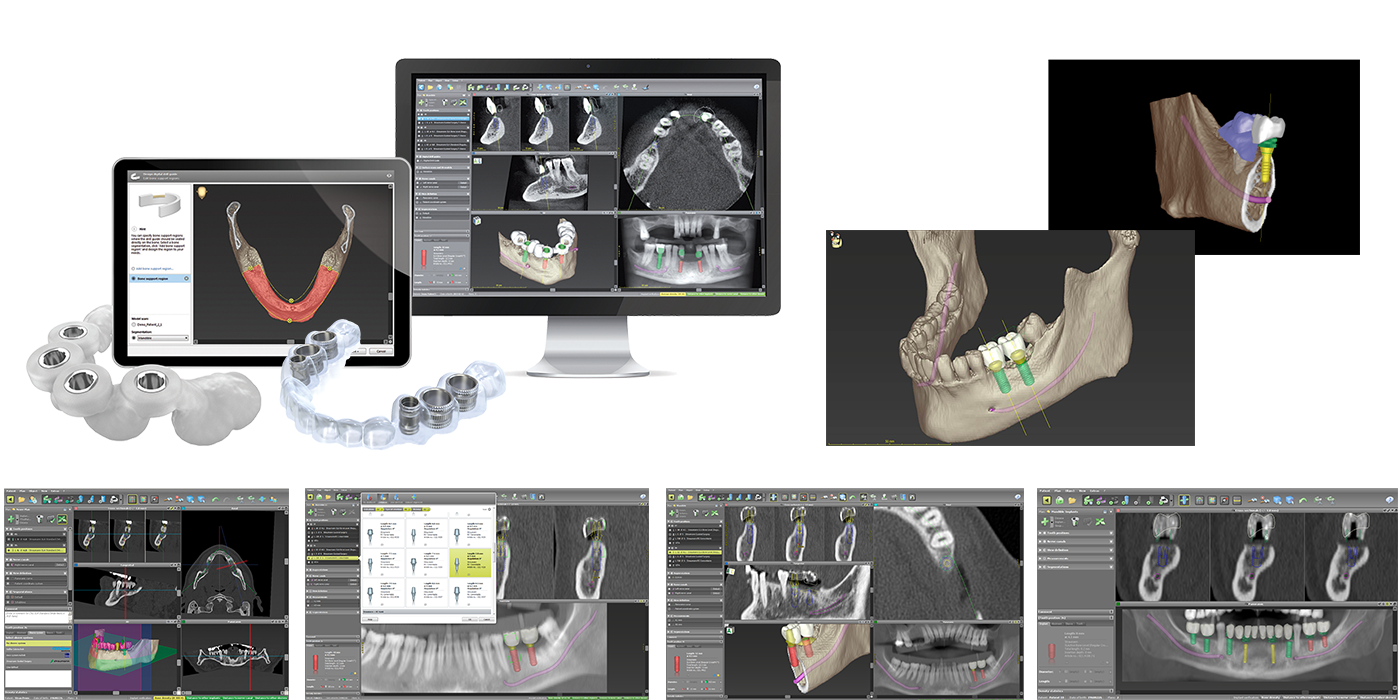 coDiagnostiX™