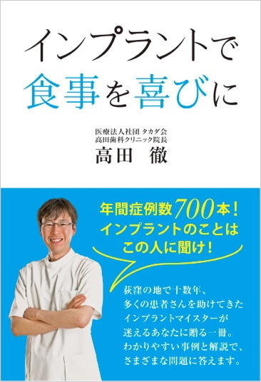 インプラントで食事を喜びに